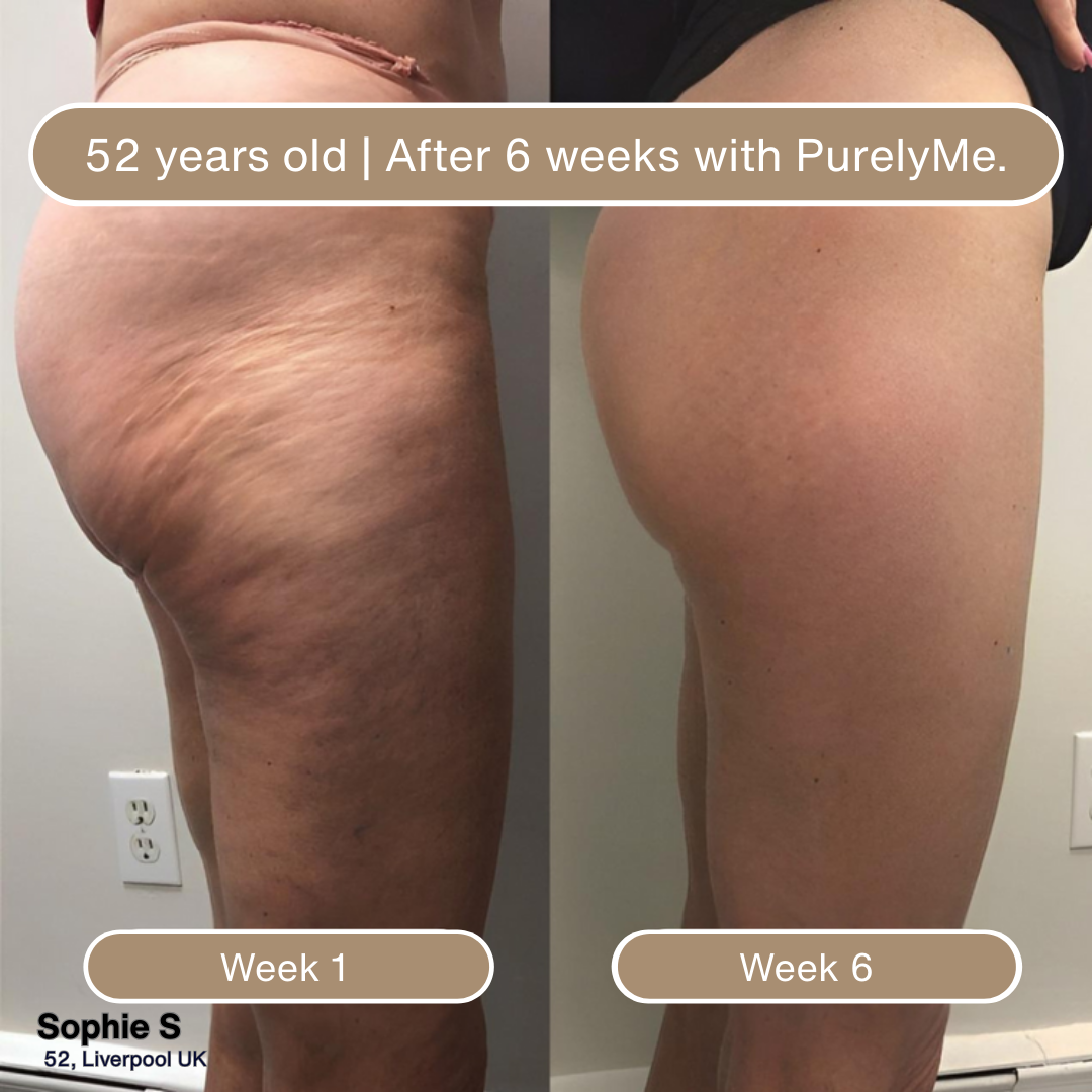 PurelyMe. Anti-Cellulite Massage Oil