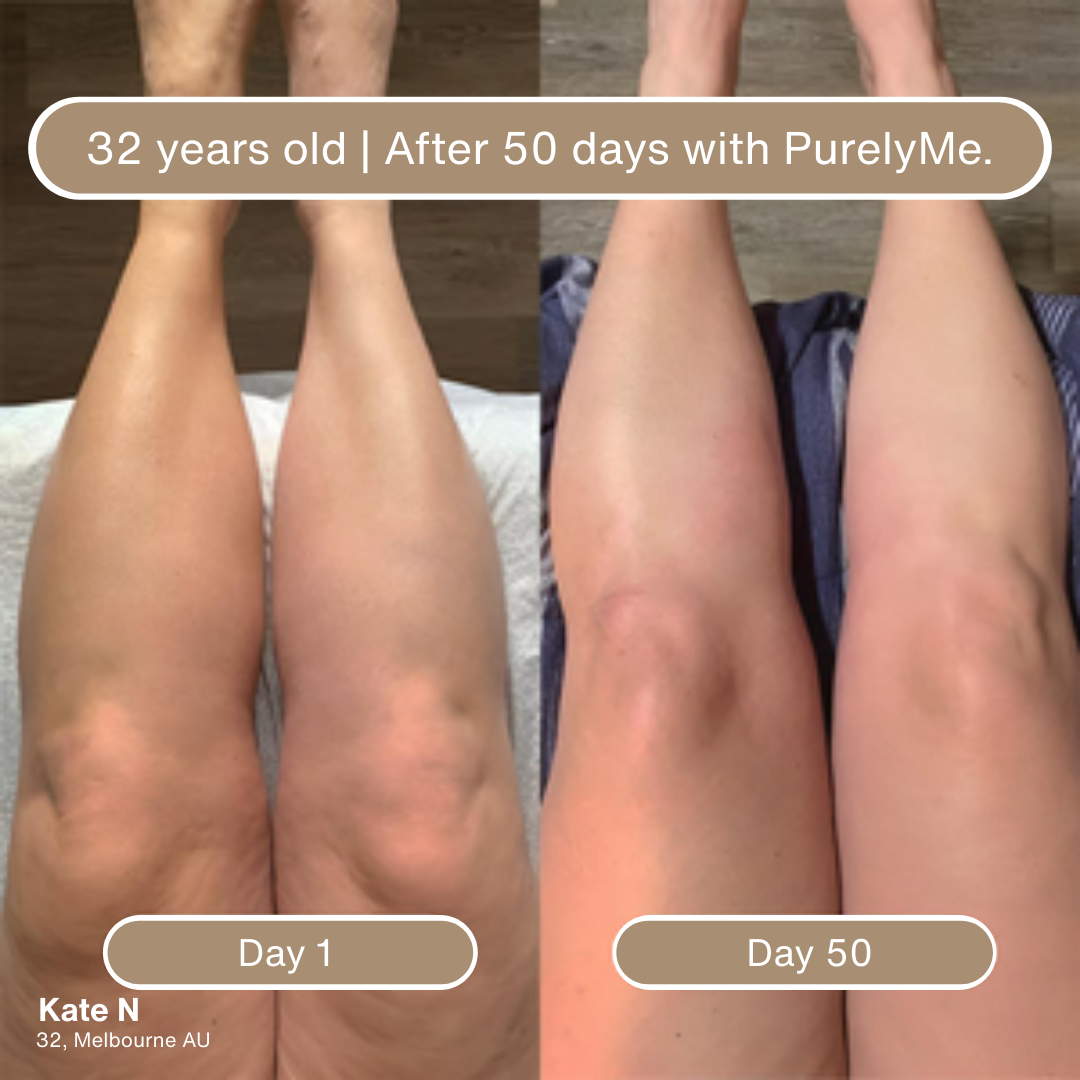 PurelyMe. Anti-Cellulite Massage Oil