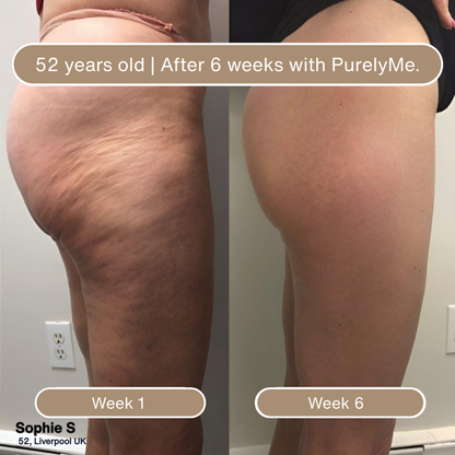 PurelyMe. Anti-Cellulite Massage Oil